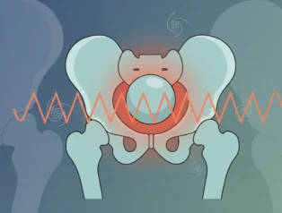 Doğuştan ve Sonradan Kalça Eklemi Kısıtlılığı için Engelli Raporu Kriterleri
