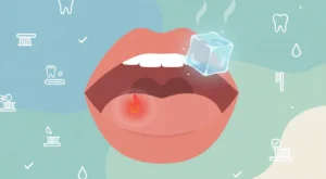 Ağız İçi Yanıklarında Hızlı İyileşme Rehberi: Sıcak İçecek Yanıklarına Pratik Çözümler