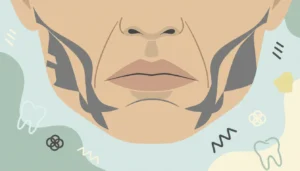 Diş Sıkma (Bruksizm) Yüz Şeklini Gerçekten Değiştirir mi? Detaylı İnceleme