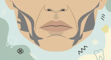 Diş Sıkma (Bruksizm) Yüz Şeklini Gerçekten Değiştirir mi? Detaylı İnceleme