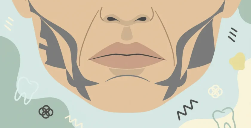 Diş Sıkma (Bruksizm) Yüz Şeklini Gerçekten Değiştirir mi? Detaylı İnceleme