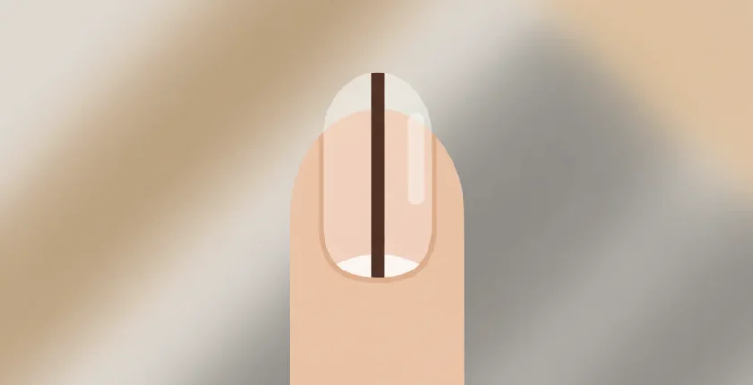 Tırnakta Siyah Çizgi (Melanonişi): Ne Zaman Endişelenmeli ve Doktora Gitmeli?