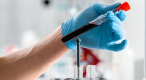 Kan Tahlili Kısaltmaları ve Anlamları: Hemogram (CBC) Sonuçlarını Okuma Rehberi Kan Tahlili Kısaltmaları ve Anlamları: Hemogram (CBC) Sonuçlarını Okuma Rehberi